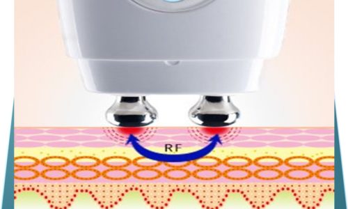 RF